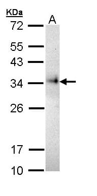 IHC-plus™ CD74 / CLIP Antibody (aa1-58)