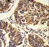 PABPC1 / PABP1 Antibody (aa250-279)
