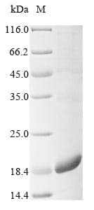 Mouse SPINK2 Protein (Recombinant 10His, N-terminus + Myc, C-terminus)