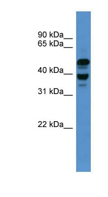 ASCC1 Antibody (C-Terminus)