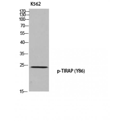 TIRAP Antibody (30-110 aa)