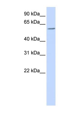 ZBTB7A / Pokemon Antibody (aa108-157)
