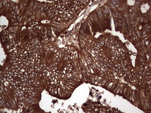 PKM2 Antibody (clone OTI12D5, Carrier-free)