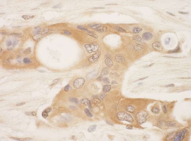 Polyclonal Rabbit anti-Human STK39 / SPAK Antibody (aa425-450, IHC)