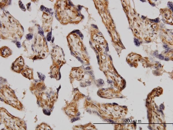 MAPK3 / ERK1 Antibody (clone 3C9)