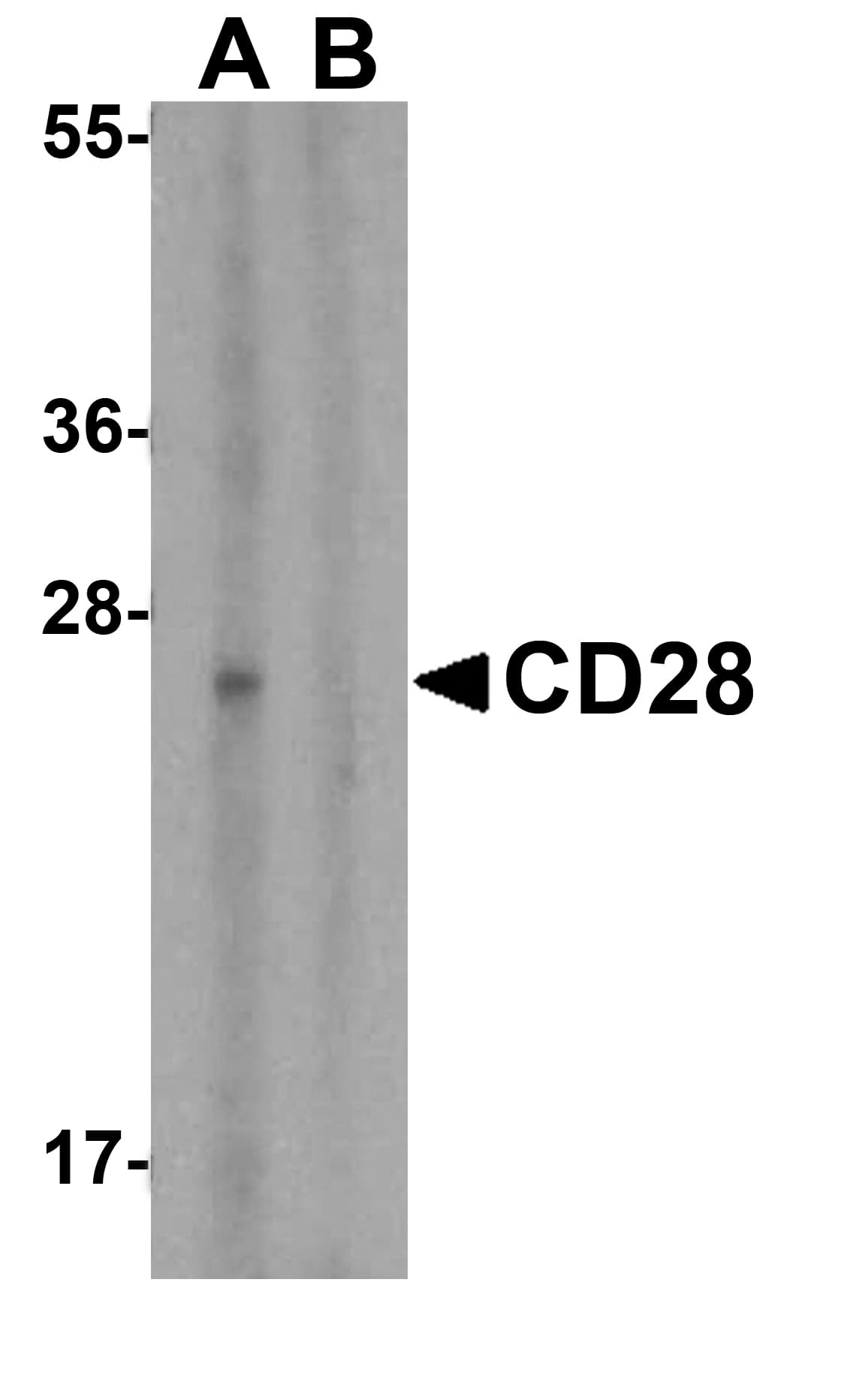 IHC-plus™ Polyclonal Rabbit anti-Human CD28 Antibody (IHC, IF, WB)