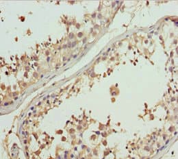 Polyclonal Rabbit anti-Human GNS Antibody (IHC, WB)