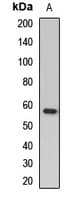 MYOC / Myocilin Antibody