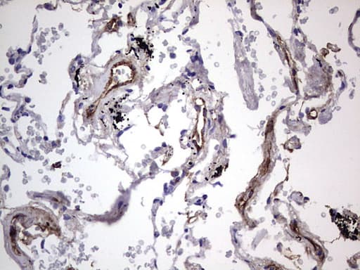 VWF / Von Willebrand Factor Antibody (aa764-1263, clone OTI6C7)