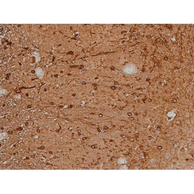 MAPT / Tau Antibody (phospho-Thr231)