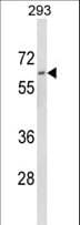 DOLK Antibody (aa312-339)