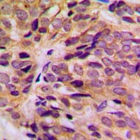 Polyclonal Rabbit anti-Human KRT16 / CK16 / Cytokeratin 16 Antibody (C-Terminus, IHC, IF, WB)