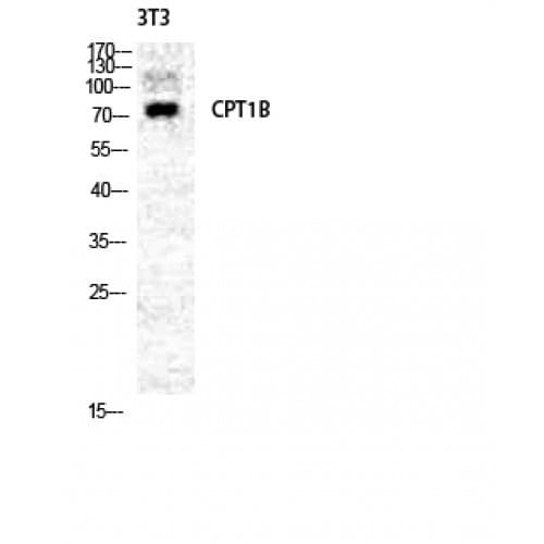 Polyclonal Rabbit anti-Human CPT1B Antibody (370-450 aa, Internal, IHC, WB)