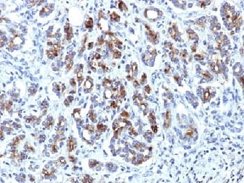 Alpha-1-Antichymotrypsin Antibody (clone AACT/1451)