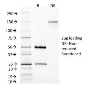 MAML3 / CAGH3 Antibody (clone MAML3/1303)