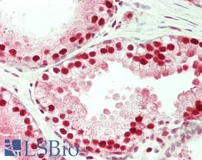 IHC-plus™ Polyclonal Rabbit anti-Human FKBP5 / FKBP51 Antibody (aa407-457, IHC, WB)