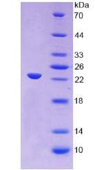 Human ORM1 / Orosomucoid Protein (Recombinant His, N-Terminal)