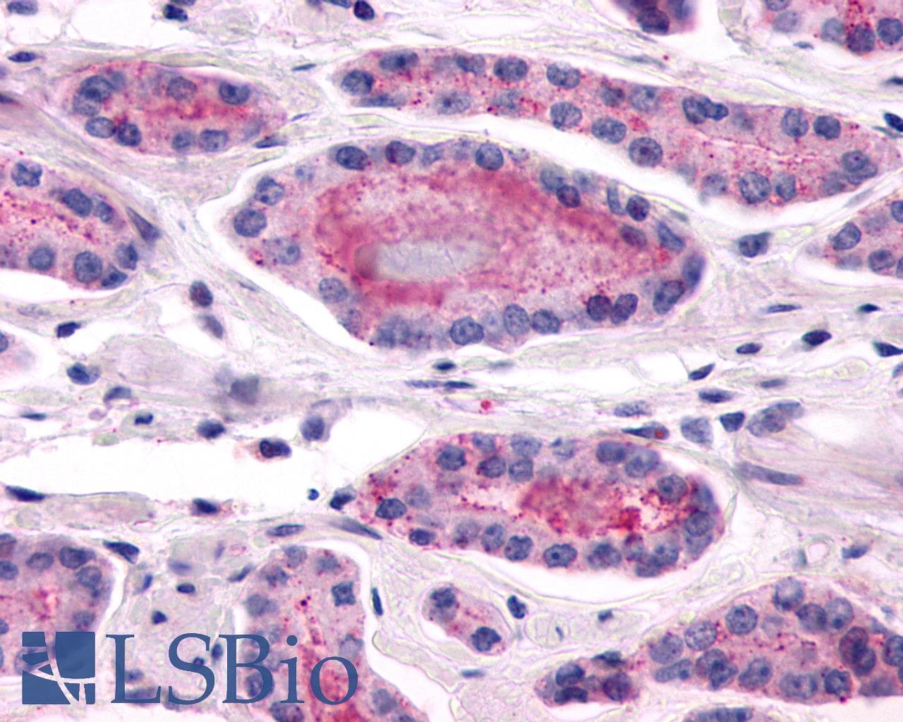 IHC-plus™ ADGRL2 / LPHN2 Antibody (N-Terminus)