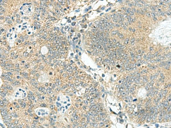 SORBS2 / ARGBP2 Antibody