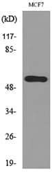 KRT14 / CK14 / Cytokeratin 14 Antibody