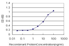 PDGFRB / PDGFR Beta Antibody (clone 4C12)