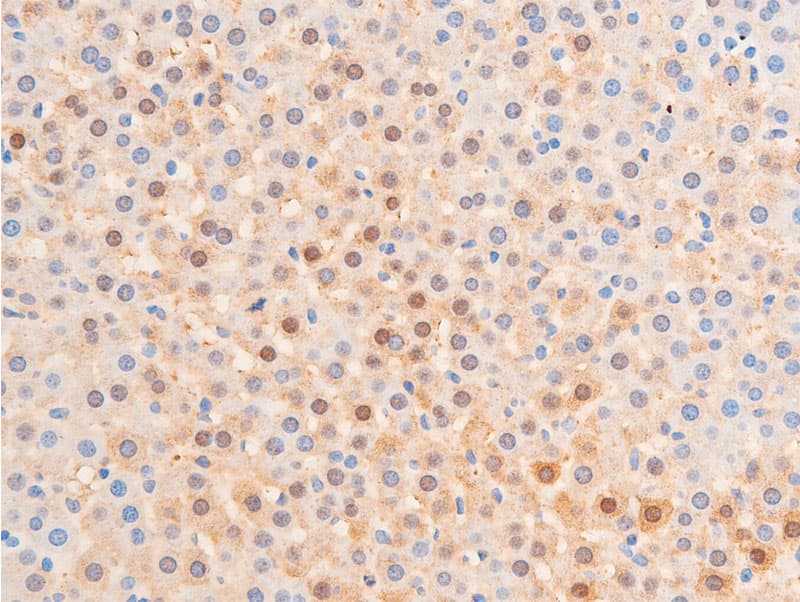 Polyclonal Rabbit anti-Human CHEK1 / CHK1 Antibody (phospho-Ser317, IHC, IF, WB)