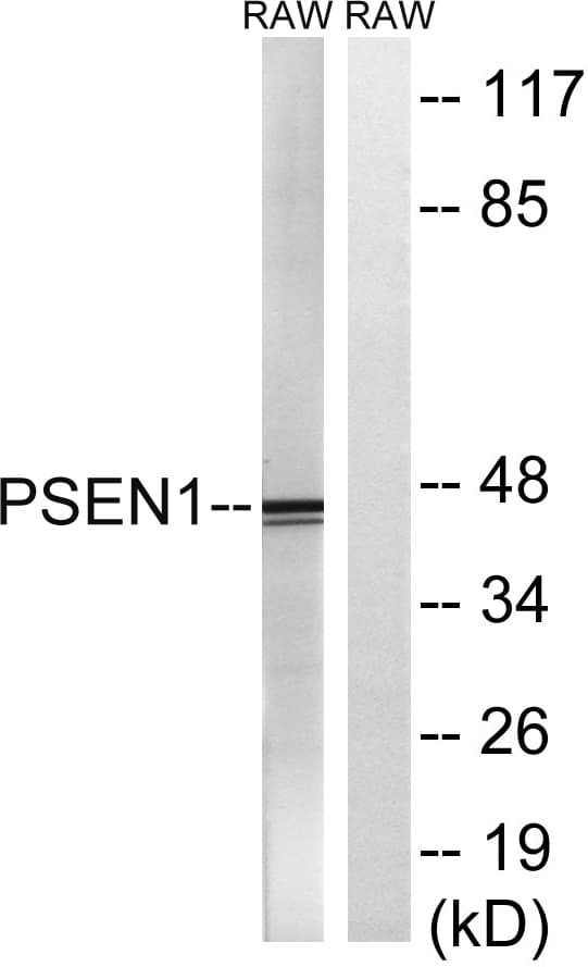 PSEN1 / Presenilin 1 Antibody (aa323-372)