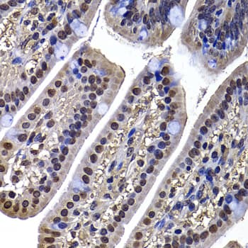 Polyclonal Rabbit anti-Human DNAJB6 Antibody (IHC, IF, WB)