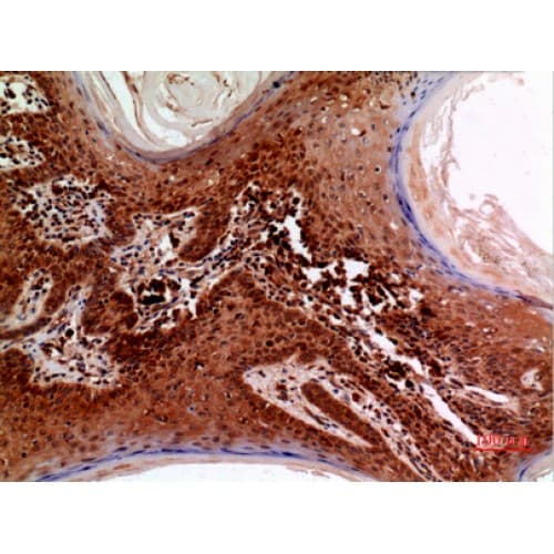 RFC1 / RFC Antibody (1071-1120 aa, C-terminal)
