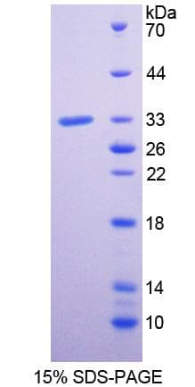 Human PLXNA1 / Plexin A1 Protein (Recombinant His-T7)