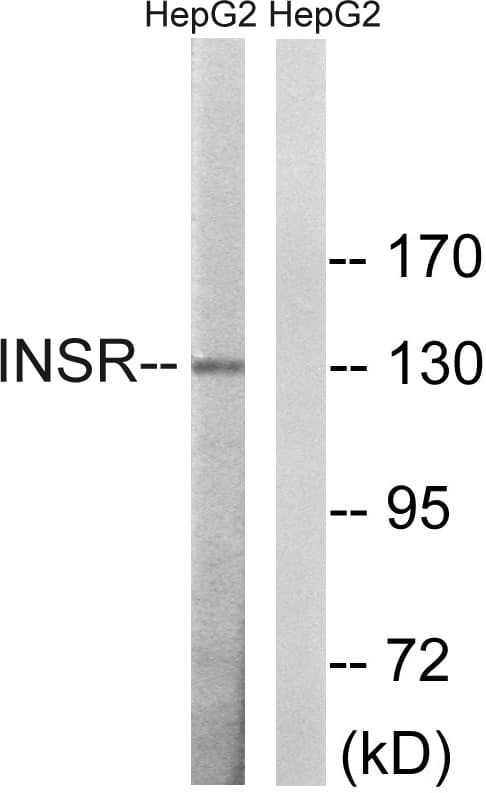 Polyclonal Rabbit anti-Human INSR / Insulin Receptor Antibody (aa1331-1380, WB)