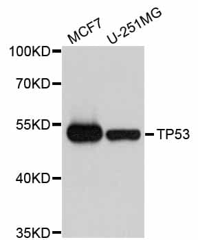 Polyclonal Rabbit anti-Human TP53 / p53 Antibody (IF, WB)