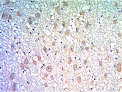 KLHL21 Antibody (clone 2H4)