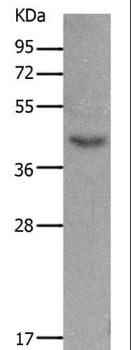 MC5R / MC5 Receptor Antibody