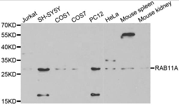 Polyclonal Rabbit anti-Human RAB11A Antibody (IHC, IF, WB)