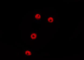 Polyclonal Rabbit anti-Human RAPGEF5 / GFR Antibody (IF, WB)