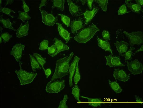Monoclonal Mouse anti-Human LETM1 Antibody (clone 6F7, IHC, IF, WB)