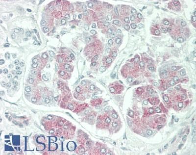 IHC-plus™ Polyclonal Rabbit anti-Human PNLIP / PL / Pancreatic Lipase Antibody (aa312-341, IHC, WB)