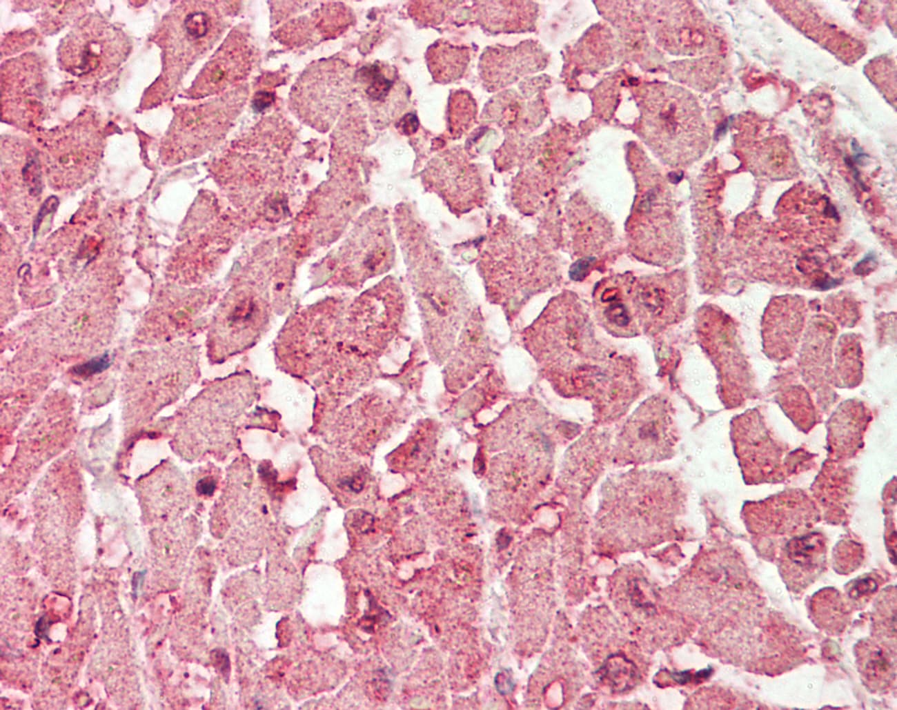 Polyclonal Rabbit anti-Human PPP2R4 Antibody (aa271-320, IHC, WB)