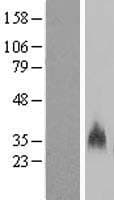 GYPB / CD235b / Glycophorin B Protein (Over-Expression Lysate Myc-DDK (Flag))