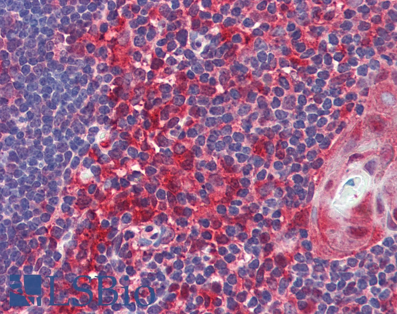 CASP8 / Caspase 8 Antibody