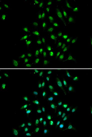IHC-plus™ Polyclonal Rabbit anti-Human CXXC1 / CGBP Antibody (IHC, IF, WB)