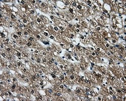 Monoclonal Mouse anti-Human LOX / Lysyl Oxidase Antibody (clone OTI6B11, IHC, IF, WB)