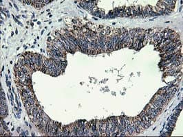 CCM2 / Malcavernin Antibody (clone OTI1E9)