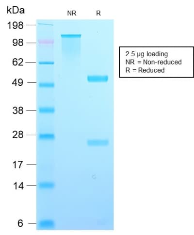 TIMP2 Antibody (N-Terminus, aa56-66, clone TIMP2/2488R)