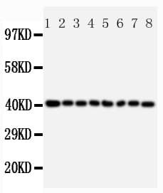 Polyclonal Rabbit anti-Human PPID / Cyclophilin D Antibody (aa351-370, IHC, WB)