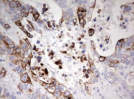KRT20 / CK20 / Cytokeratin 20 Antibody (clone OTI2H9)