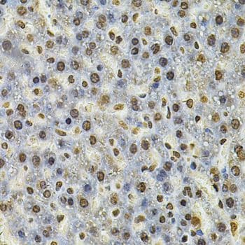 IFI16 Antibody
