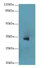 Polyclonal Rabbit anti-Human DHRS3 / SDR1 Antibody (IHC, WB)