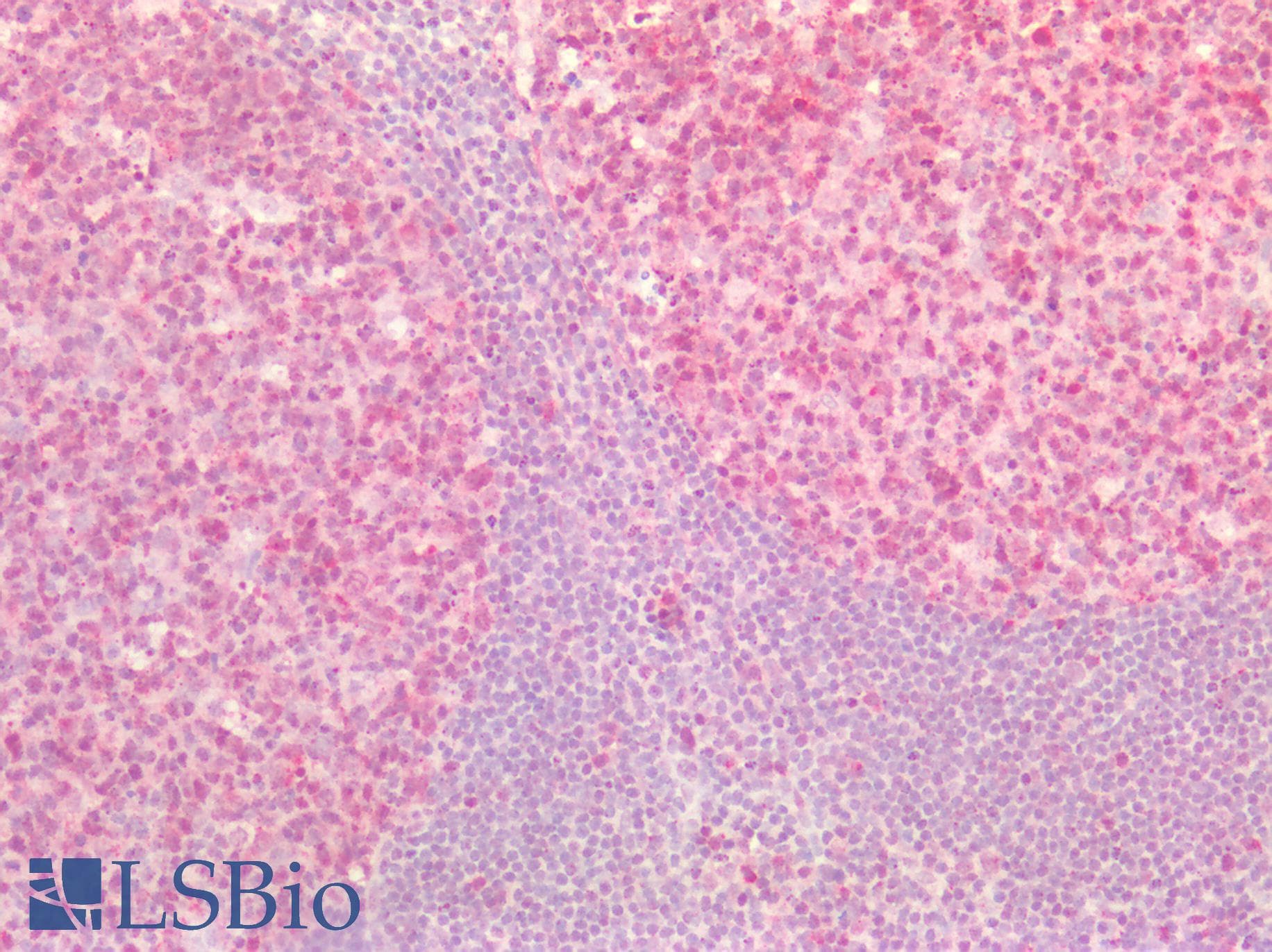 PathPlus™ ST6GAL1 / CD75 Antibody (aa178-206)